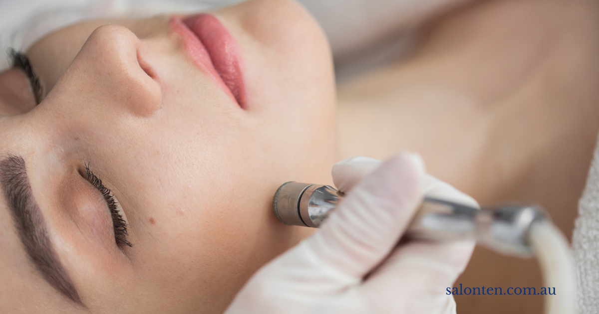 Microdermabrasion handpiece being worked across the cheek during a treatment